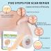 Medical Grade Silicone Scar Sheets - 1.6 x 60 inches - C-Section, Keloids, Tummy Tuck - Reduce Scarring and Promote Healing - Buy Online on GoSupps.com