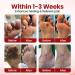 Cr me Pieds Diab tiques 20g Cr me Pieds Talons Crevass s Peau S che Cr mes Naturelles R paratrices Talons Crevass s Aux Extraits Plant Cr mes Hydratantes Profondeur Talon Crevass ss S che - Buy Online on GoSupps.com