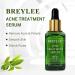 Tea Tree Acne Treatment Serum - Clear Severe Acne Breakouts & Repair Skin - 40ml (1.41fl oz) - Buy Online on GoSupps.com