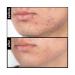 Moisture Treatment | Deep Hydration for Healthy Skin | International Shipping Available - Buy Online on GoSupps.com