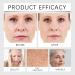 Retinal Skin Booster Serum Reduces Hyperpigmentation Anti-Ageing Skincare Fades Dark Spots Retinol Anti-Aging Whitening Spray for Face - Retinal Facial Serum for Uneven Skin Tone (150ml 1pc) 1pc 150 ml (Lot de 1) - Buy Online on GoSupps.com