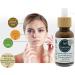 Nativilis Triple Virgin Amazonian Rainforest Bio Oil - ANDIROBA - BACURI PRACAXI - enriched 03 Vegetable Oils Concentrated Active Efficacy Treatment Prevention Cellulitis - Copaiba - Buy Online on GoSupps.com