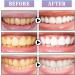 Bright White Tooth Whitening Pencil - Fast Spot Removal No Sensitivity | Travel-Friendly 2-Pack - Buy Online on GoSupps.com