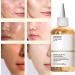 Glycolic Acid 7 Toning Resurfacing Solution Peeling Solution 7 Glycolic Acid Hydrating Toner Hydrating Toner for Face 7% Glycolic Acid Serum Glycolic Acid Toning Solution - Buy Online on GoSupps.com