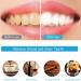 Lamkrtlp 28pcs Whitening Strips - Effective Teeth Whitening for Bright White Smile | Remove Yellow Smoke & Black Stains - Buy Online on GoSupps.com