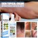 CCZGCP Meellop Herbal Psoriasis Relief Spray 30ml - Natural Ingredients for All Skin (4pcs) - Buy Online on GoSupps.com