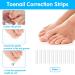 Jeffdad Ingrown Toenail Treatment Kit | Professional Removal & Correction | Lifter & Clipper Included | Quick & Effective Nail Repair - Buy Online on GoSupps.com