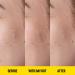PEACE OUT Acne Day Dot | 6-Hour Fast-Acting Pimple Patch with Salicylic Acid | Clear Breakouts & Blemishes in Hours (20 Dots) - Buy Online on GoSupps.com