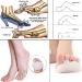 Forefoot Metatarsal Gel Pad Cushions - Sichun White Insole Toe Loop for Foot Pain Relief | International Shipping - Buy Online on GoSupps.com
