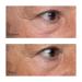Perricone MD High Potency Classics: Growth Factor Firming & Lifting Eye Serum  0.5 oz. - Buy Online on GoSupps.com