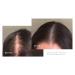 Virtue Flourish Hair Growth Regimen for Women - Minoxidil 5% Foam for Fine & Thinning Hair | Sulfate Free & Color Safe - International Shipping Available - Buy Online on GoSupps.com