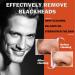 Blackhead Nose Strips Nose Strips Pore Strips Pore Cleansing Remove Blackheads and Impurities (10) - Buy Online on GoSupps.com