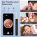 Wireless HD 1080P Ear Wax Removal Camera with 3.5mm Otoscope, 6 LED Lights - Waterproof Ear Scope for iPhone, iPad & Android - Kids, Adults, Pets - Black - Buy Online on GoSupps.com