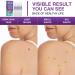 Skin Tag & Wart Remover Set - Fast-Acting Extra Strength Formula for Face & Body - Buy Online on GoSupps.com