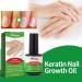 Keratin 3 Day Growth Nail Treatment & Strengthener - Nail Strengthener for Damaged Nails Thin Nails - Nail Growth Treatment for Nail Strengthener - Fast Keratin Nail Hardener - Buy Online on GoSupps.com