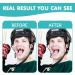 2 Pcs Fake Tooth Temporarily Fix Your Teeth Instant Smile Moldable Thermal Fitting Beads Adjust to Fit Your Teeth Replace a Missing Tooth for Teeth Whitening Kit - Buy Online on GoSupps.com