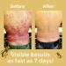 EXQST New Zealand Bee Venom Psoriasis Soothing Moisturizing Cream - Buy Online on GoSupps.com