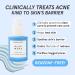 HERBIVORE Blue Wave Clearing Serum | Acne Treatment with 2% Salicylic Acid Blue Tansy & Willow Bark | Plant-Based Vegan Cruelty-Free | 30mL - Buy Online on GoSupps.com