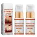 GFOUK Acanthoclear Therapy Spray GFOUK Acanthosis Nigricans Therapy Oil Dark Spot Corrector Spray (2 PCS)
