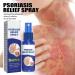 XRCZYM South Moon Psoriasis Repair Spray - Professional Relief Treatment for Plaque Psoriasis - Skin Treatment - 5pcs - Buy Online on GoSupps.com