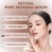 Retinol Serum for Face - Retionl Face Serum with Niacinamide - Anti-Aging & Anti-Wrinkle Face Serum for Women - Niacinamide Serum - Hydrating Serum - Dark Spot Remover for Face - Skin Care - Buy Online on GoSupps.com