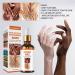 Whitening Serum Hand Knuckle Glow Serum - 2PCS, 1.7 Fl Oz - Restoring Treatment for Dark Knuckle Elbow - Moisturizing & Exfoliating Formula for Brighter, Firmer Skin - Buy Online on GoSupps.com