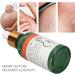 Scar Prevention & Stretch Mark Repair Essential Oil - Premium Beauty Solution for Women | Shop Now! - Buy Online on GoSupps.com
