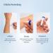EVOLSIN Anti Kst | Chemical-Free Insect Bite Treatment | Electric Stitch Healer for Itch & Swelling | No Batteries Required | Safe for Kids 6 Months+ - Buy Online on GoSupps.com