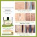 ANRUI Varicose Veins Cream Spider Leg Repair Cream Improve the Apperance of Legs Relief Phlebitis Angiitis Inflammation Tired and Heavy Legs Fast Relief Soothing Leg Cream/50g (1 PACK) - Buy Online on GoSupps.com