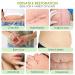 Buy AUSLKA Silicone Scar Sheets 1.6 x 120 Roll Professional Scar Tape for C-Section Tummy Tuck Keloid & Scar Treatments Fast International Shipping - Buy Online on GoSupps.com