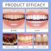 Dentifrice For Le Soin Des Dents - claircit Progressivement Les Dents Renforce L' mail Fra cheur Longue Dur e Nettoyage Quotidien(2PCS) - Buy Online on GoSupps.com