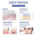 Professional Grade Silicone Scar Removal Sheets - 1.6 x 120 3M - For C-Section Surgery, Burn, Acne, Stretch Marks - Works on Old & New Scars - Reusable - Buy Online on GoSupps.com