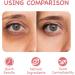 Ninnyi Waterproof Double Eyelid Cream with Y Stick Long Lasting Invisible Double Eyelid Shaping Styling Cream - Buy Online on GoSupps.com