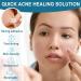 L otFancy Acne Patches 240 Count - Hydrocolloid Pimple Patches for Face - 3 Sizes for Blemishes & Spots - Skin Acne Dots Treatment - Buy Online on GoSupps.com