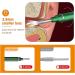 KANDUO Ear Curette Ear Cleaner with Camera Ear Cleaner Earwax Removal Camera 1080P FHD Endoscope Wireless Ear Wax Remover Otoscope with LED Light Safe Ear Wax Removal Kit for Adults Kids &Pets - Buy Online on GoSupps.com