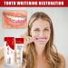 Sp-10 Ultra Whitening Toothpaste Ultra Whitening Sp-10 Probiotic Toothpaste Lightening Sp-10 Sp 10 Ultra Whitening Toothpaste Sp-10 Ultra Whitening Toothpaste Sp-10 With Toothbrush - Buy Online on GoSupps.com