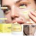 Turmeric Soap Bar & Clay Mask Set - Natural Acne Treatment Deep Cleansing Facial Care | Control Oil & Smooth Skin - Buy Online on GoSupps.com