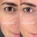 Vice Reversa Eye Rejuvenator - Hyaluronic Acid Under Eye Patches for Hydration & Brightening - MicroCrystal Skincare (12 Pairs) - Buy Online on GoSupps.com