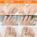 Facial hair removal cream - gentle hair removal cream for sensitive skin | Moisturizing hair remover for the chin and upper lip | Hair removal cream - Buy Online on GoSupps.com