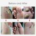 MQ 36PC Chicken Eyes Removal Pads - Effective Foot Care for Stubborn Corns & Calluses - International Shipping Available - Buy Online on GoSupps.com