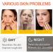 mercham Skincare Set Gifts for Teenage Girls-Vitamin C Serum for Womens Gift Sets Includes Cleanser-Toner-Serum-Face Cream Moisturizing & Brightening Facial Kit Preppy Skincare Set - All Skin Types - Buy Online on GoSupps.com
