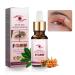 Stye Eye Treatment Eye Stye Remover Chalazion Remover Fast Relief Styes Chalazion And Blepharitis