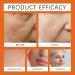 8-In-1 Bee Venom & Tallow Skin Firming &Treatment Cream Bee Venom Skin Treatment Cream Deeply moisturizes firms and repairs skin blemishes(2PCS) - Buy Online on GoSupps.com