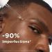Mixa - Anti-Imperfections Concentrated Serum - For blemish-prone skin - Enriched with Salicylic Acid and Niacinamide - 30 ml - Buy Online on GoSupps.com