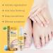 Bee Venom S rum de reconstruction des ongles venin d'abeille spray de soin des ongles s rum de r paration pour ongles des mains et des pieds d fense des ongles renforcement des cuticules - Buy Online on GoSupps.com