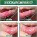 Mouth Ulcer Treatment Spray Mouth Ulcer Spray Mouth Ulcer Relief Spray Canker Sore Treatment Ulcer Treatment Tongue Breath Spray for Bad Breath Ulcer Treatment Canker Relief Spray Mouth Freshener - Buy Online on GoSupps.com