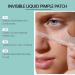 Acne Patches - Acne Treatment - Dark Spot Remover for Face - Liquid Pimple Patch - Spot Cream - 2% Salicylic Acid Acne Care - Face Saver Gel - Gentle Spot Gel Face Spot Treatment - Buy Online on GoSupps.com