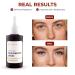 ABERA Saffron Serum For Melasma Treatment Renewing for Face Anti-Aging Treatment for Fine Lines & Wrinkles High Potency Saffron Extract Hydrating Serum Dark Spot Remover (2 BOXES) 1.01 Fl Oz (Pack of 2) - Buy Online on GoSupps.com