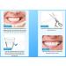 Temporary Tooth Replacement Kit Bundle Set - 30 Fake Teeth in 3 Shades - Includes Temp Tooth Beads, Lip Expander, and 200 Thermal Beads - DIY Tooth Replacement Solution - Buy Online on GoSupps.com