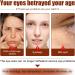 Milk Spots Remover Eye Cream Milia Remover Eye Cream Milia Spot Treatment Eye Cream Milk Spots Removal Eye Cream Smooth Milia Eyes Cream Milia Spot Treatment Eye Cream - Buy Online on GoSupps.com